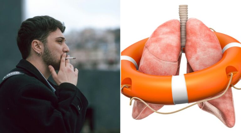 Major reasons why you should stop smoking