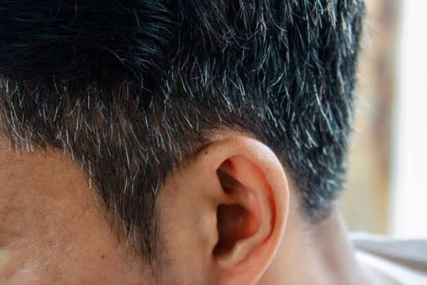 If Your Hair Is Turning Grey at 30, Add These 4 Foods to Your Diet for Nourishment and a Youthful Look