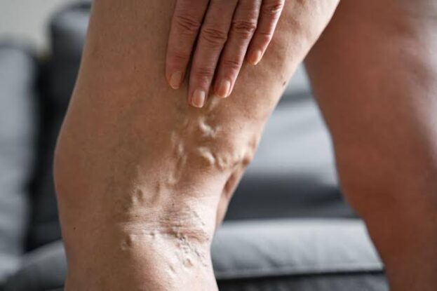 Hidden Heart Attack Alarm in Your Feet: Recognise It with These Signs