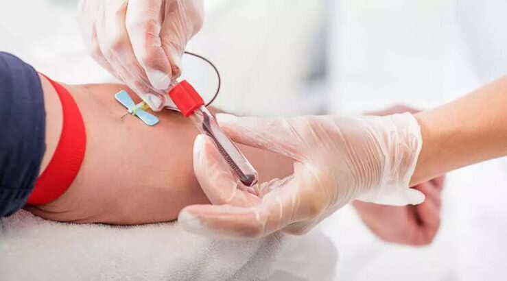 Test for heart health