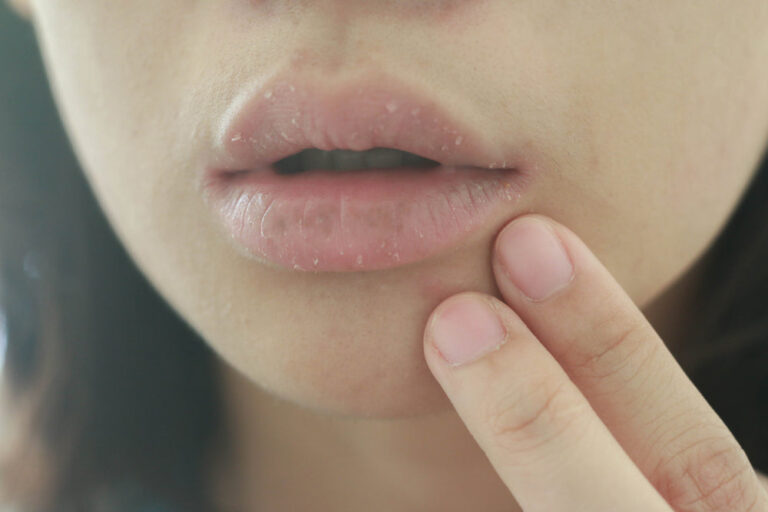 Why Vitamin E Is a Miracle Ingredient for Chapped Lips