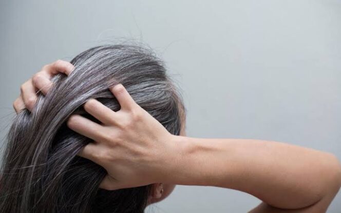 Why Are Even Young People Getting Grey Hair? Causes and Prevention Why Are Even Young People Getting Grey Hair? Causes and Prevention